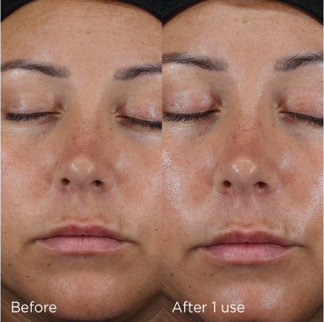 DAILY PREVENTION Ultra Defense Moisturizer SPF 50