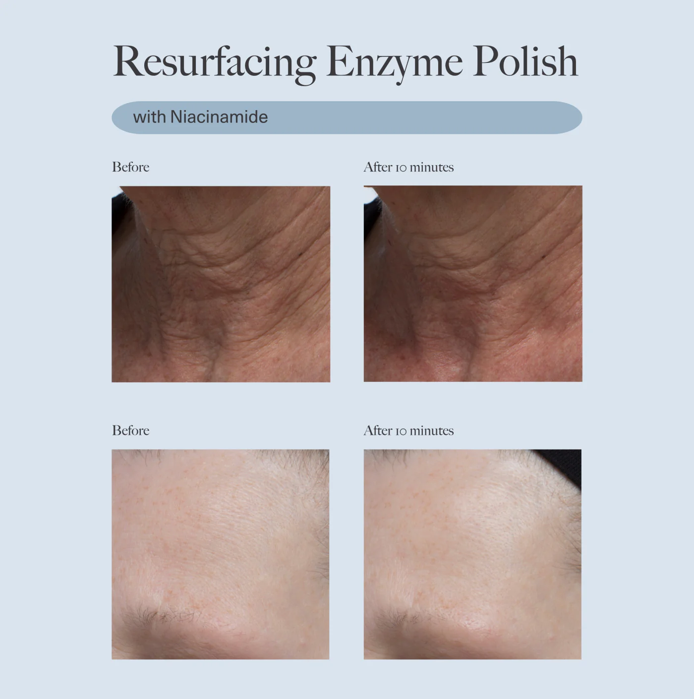 32-Resurfacing-Enzyme-Polish-3.webp Resurfacing Enzyme Polish
